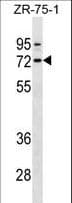 SELE / CD62E / E-selectin Antibody