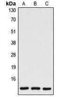 Polyclonal Rabbit anti-Human CASP7 / Caspase 7 Antibody (Internal, IF, WB)
