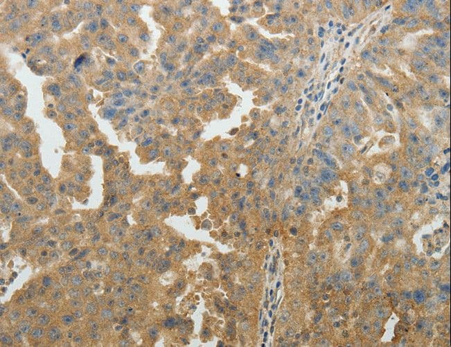 SYT6 / Synaptotagmin 6 Antibody
