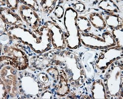IFT57 / HIPPI Antibody (clone OTI4F6)
