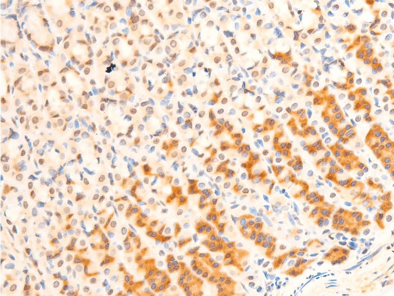 Polyclonal Rabbit anti-Human FOXO3 / FOXO3A Antibody (phospho-Ser253, IHC, WB)