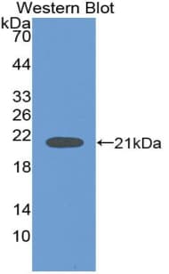 NGB / Neuroglobin Antibody (aa1-151, Cy3)