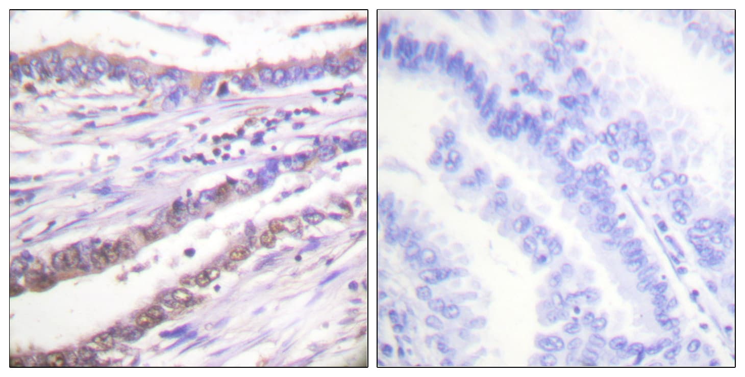 Cyclin A Antibody (Internal)