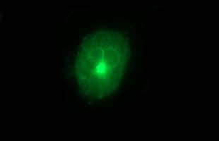 Monoclonal Mouse anti-Human MMP13 Antibody (clone OTI4B3, aa104-471, IHC, IF, WB)