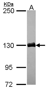 IHC-plus™ Polyclonal Rabbit anti-Human DCTN1 / Dynactin 1 Antibody (aa1216-1278, IHC, WB)