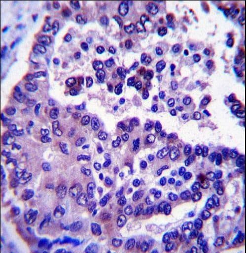 ARL8A Antibody (aa82-110)