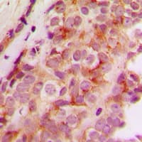 Polyclonal Rabbit anti-Human JMY Antibody (C-Terminus, IHC, WB)