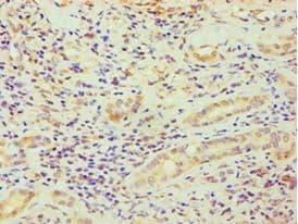 Polyclonal Rabbit anti-Human DDX5 Antibody (aa1-290, IHC, WB)