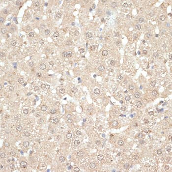 KLHDC3 Antibody