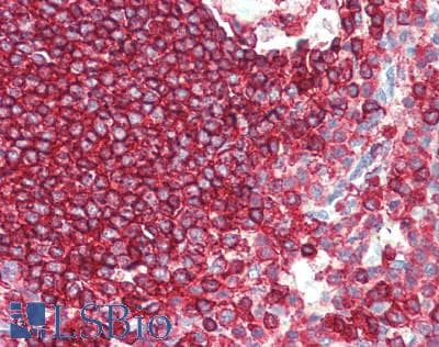 IHC-plus™ CD45 / LCA Antibody