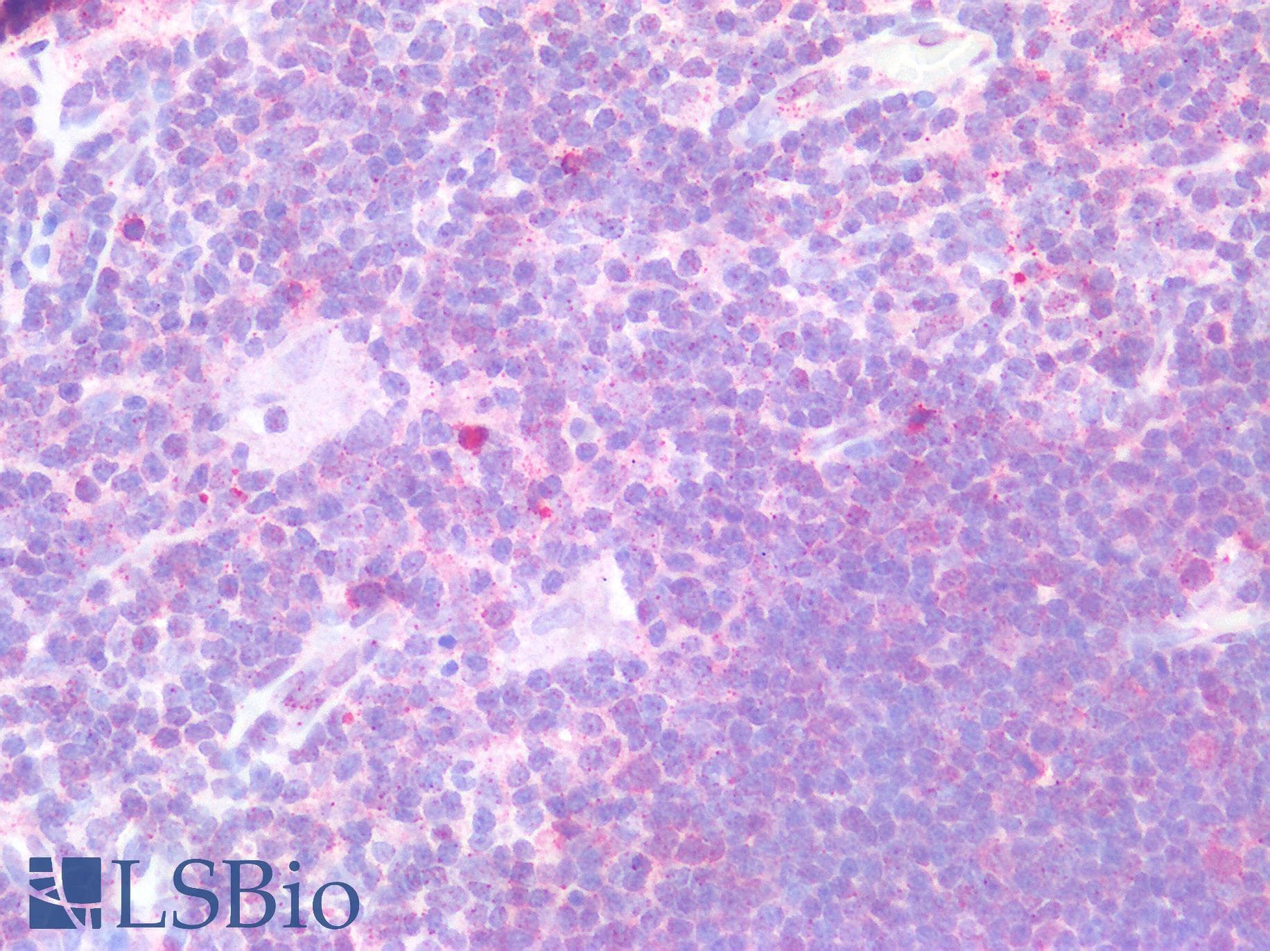 SMAD4 Antibody (clone RBT-SMAD4)