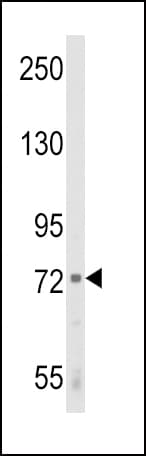IHC-plus™ ALOX12 / 12 Lipoxygenase Antibody (aa618-650)