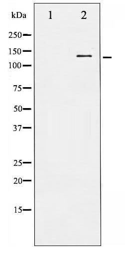 APP / Beta Amyloid Precursor Antibody (phospho-Thr743/668)
