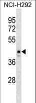 Polyclonal Rabbit anti-Human ESX1 Antibody (aa28-55, WB)