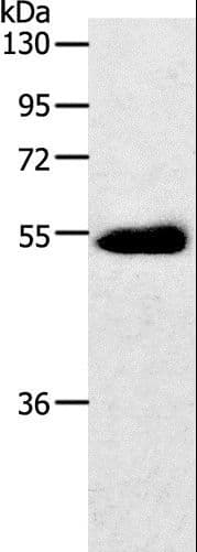 Polyclonal Rabbit anti-Human SLC2A3 / GLUT3 Antibody (WB)