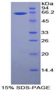 Human MMP2 Protein (Recombinant His)