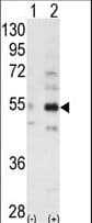 STRADB / ALS2CR2 Antibody (aa274-303)