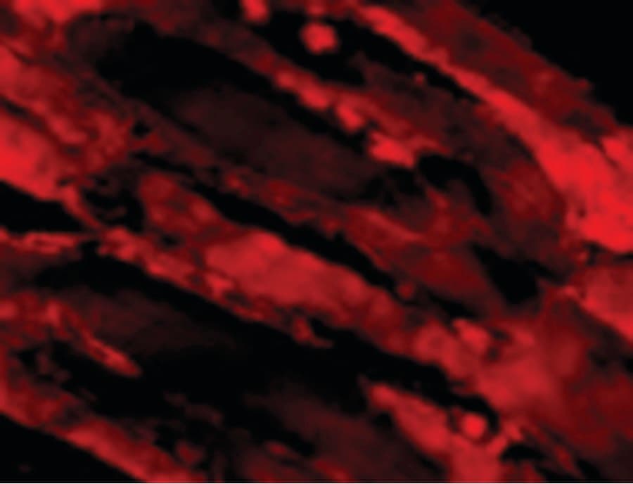IHC-plus™ IL31 Antibody