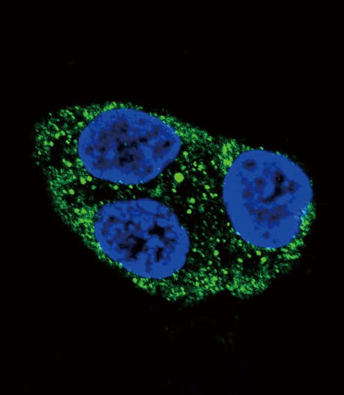Polyclonal Rabbit anti-Human Tyrosinase Antibody (aa486-513, IHC, IF, WB)