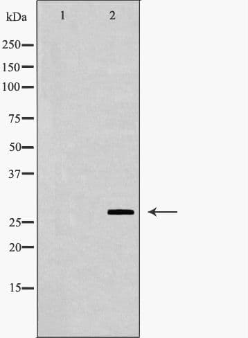 NR0B2 Antibody