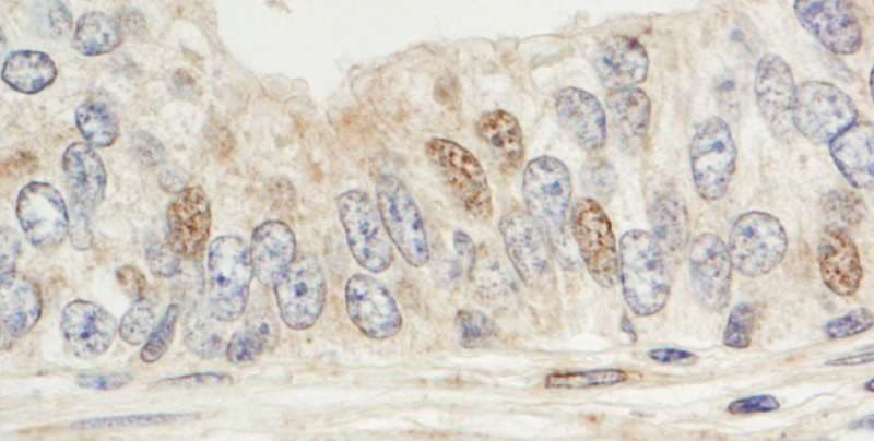 Polyclonal Rabbit anti-Human MAPKAP1 / MIP1 Antibody (aa470-C-term, IHC, WB)