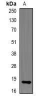 Polyclonal Rabbit anti-Human RNASE13 Antibody (IHC, IF, WB)