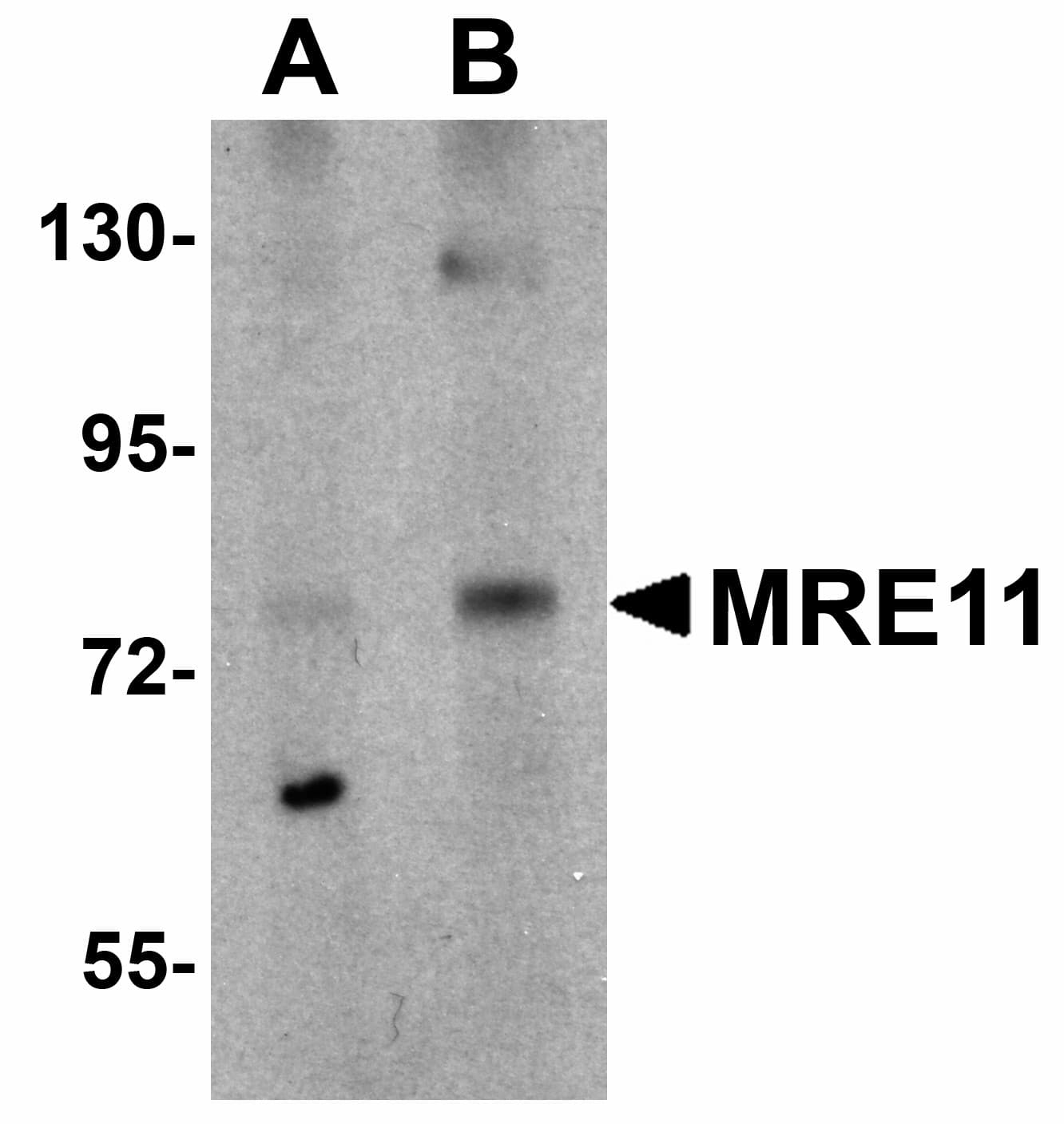 IHC-plus™ Polyclonal Rabbit anti-Human MRE11A / MRE11 Antibody (IHC, IF, WB)