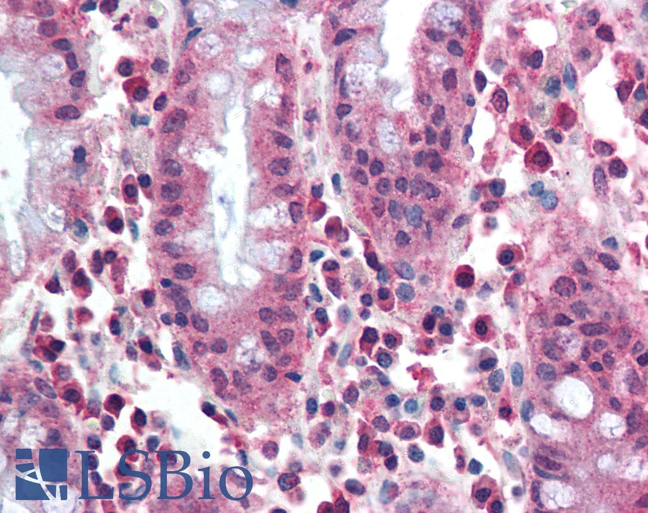 IHC-plus™ Polyclonal Rabbit anti-Human MUTYH / MYH Antibody (aa531-546, IHC, WB)