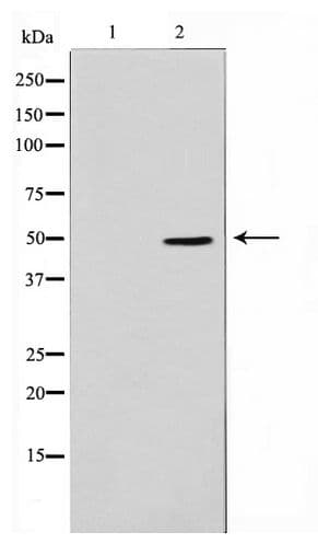ADPGK Antibody