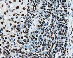 RPA2 / RFA2 / RPA34 Antibody (clone OTI9A1)
