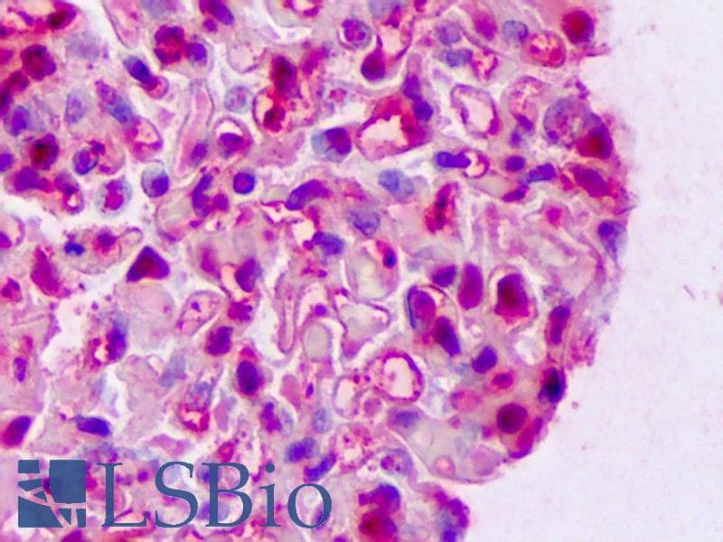 IHC-plus™ Polyclonal Rabbit anti-Human LGALS1 / Galectin 1 Antibody (IHC, WB)
