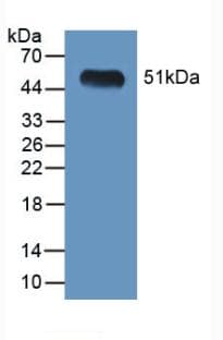 LGMN / Legumain Antibody (aa18-435)