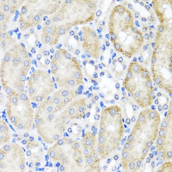 PSTPIP1 Antibody