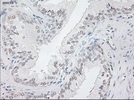 Monoclonal Mouse anti-Human NEUROG1 / NGN1 / Neurogenin 1 Antibody (clone OTI5A10, IHC, WB)