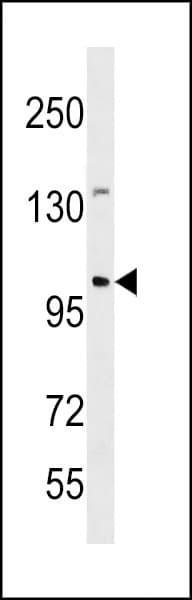 IHC-plus™ Polyclonal Rabbit anti-Human ESCO1 / ECO1 Antibody (aa661-687, IHC, WB)
