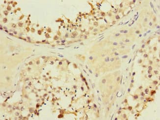 Polyclonal Rabbit anti-Human MYBL1 / A-MYB Antibody (IHC)