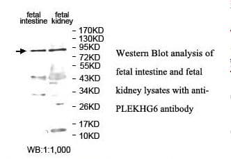 PLEKHG6 Antibody (aa196-453)