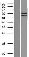 PATL2 Protein (Over-Expression Lysate Myc-DDK (Flag))