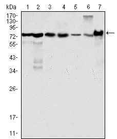 IHC-plus™ lpp Antibody (clone 8B3A11)