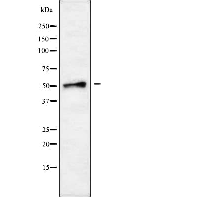 Polyclonal Rabbit anti-Human SLC18A1 / VMAT1 Antibody (WB)