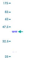 Human PFDN6 / HKE2 Protein (Recombinant GST)