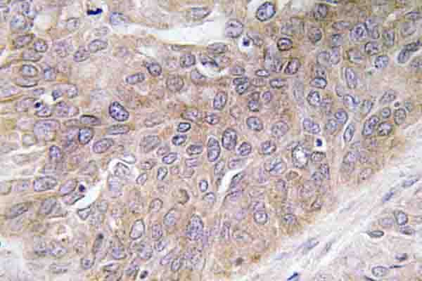 VEGFD Antibody (Ile202)