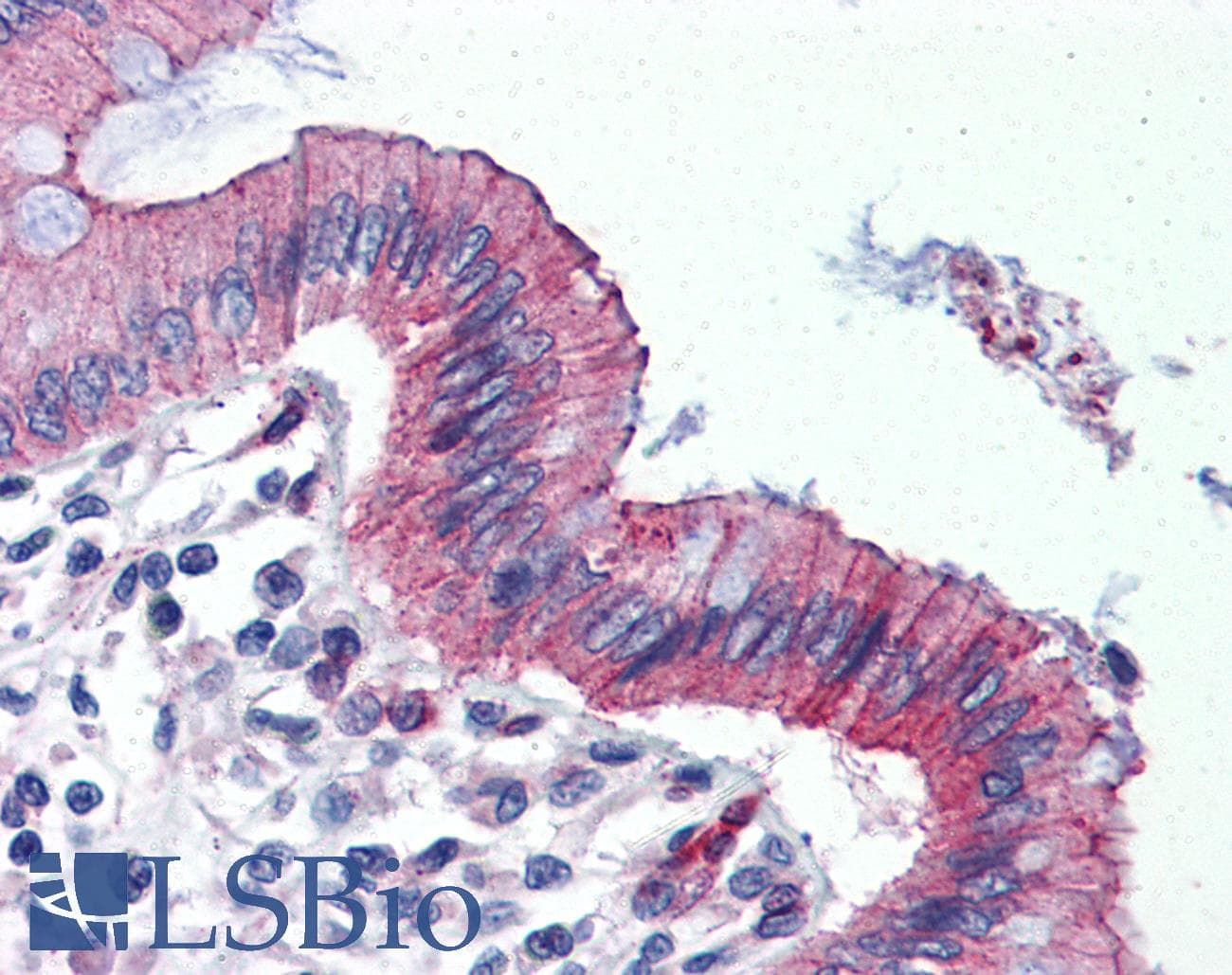 IHC-plus™ Polyclonal Rabbit anti-Human TJP3 / ZO3 Antibody (C-Terminus, IHC, IF, WB)