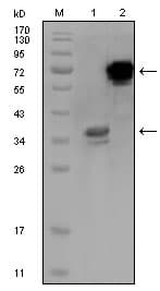 Monoclonal Mouse anti-Human HPS / HPS1 Antibody (clone 5G12G2, WB)