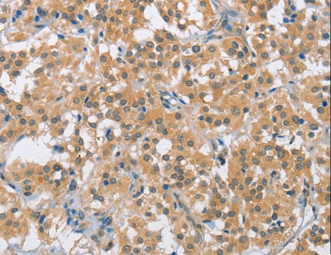 BCL10 / BCL-10 Antibody