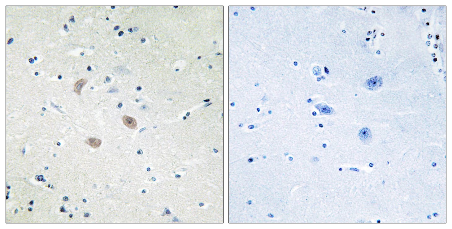 Polyclonal Rabbit anti-Human AKT2 Antibody (aa432-481, IHC, WB)