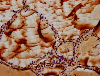 Polyclonal Rabbit anti-Human MAN2B2 Antibody (IHC)