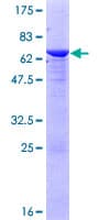 Human PPM1L Protein (Recombinant GST)