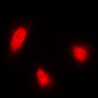 Polyclonal Rabbit anti-Human CELF1 / CUGBP1 Antibody (Internal, IHC, IF, WB)