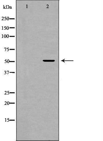 GLRA1/Glycine Receptor Alpha 1 Antibody